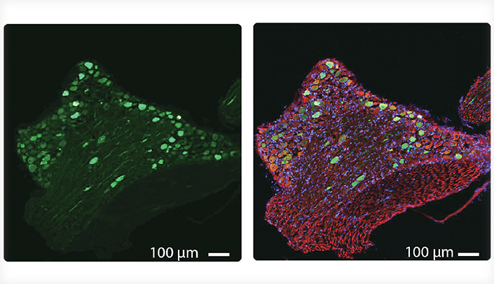 AAV infectivity Data Image courtesy of Dr. Douglas Lopes, King&rsquo;s College London.