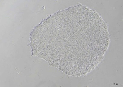 Human iPSC colony cultured with 3DCelMatrix ECM solution