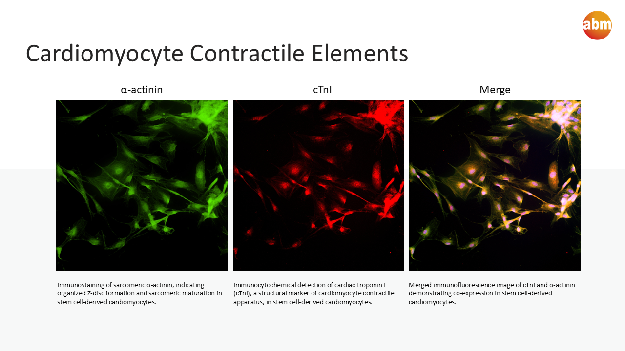 Immunocytochemistry panel showing cTnI, alpha-actinin, and merged cardiomyocyte marker staining