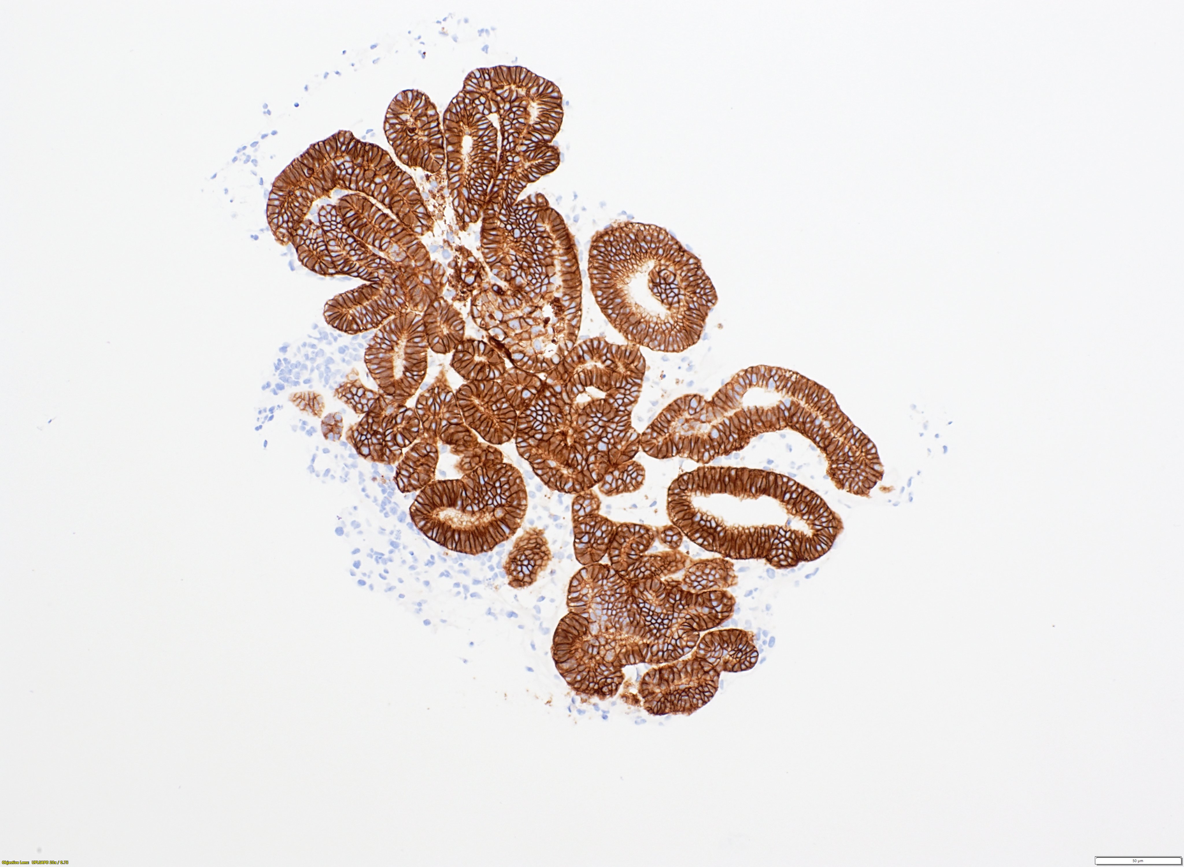 EPCAM IHC staining in kidney organoids