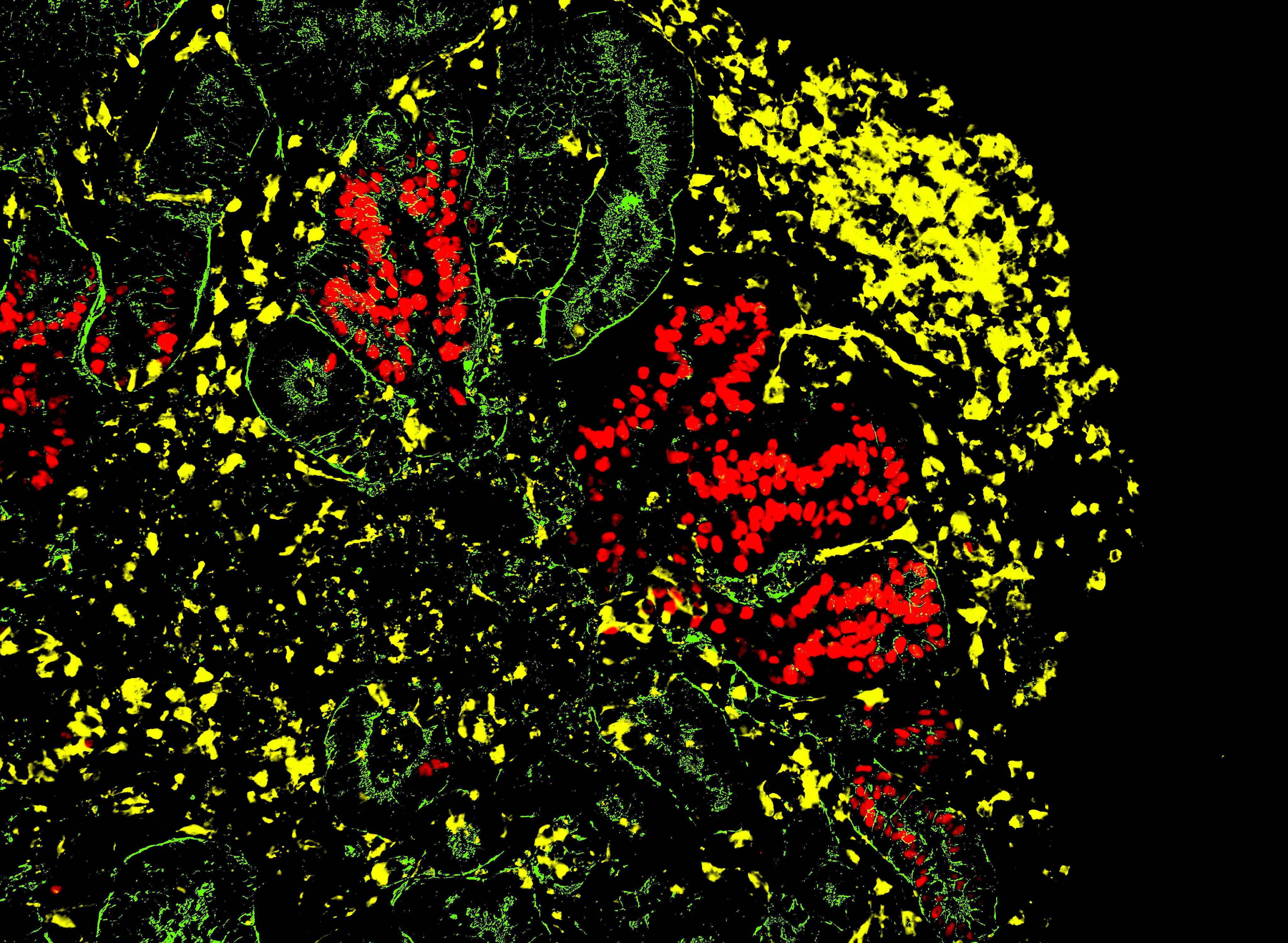 WT1 GATA3 LTL immunofluorescence staining in kidney organoids